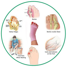 Load image into Gallery viewer, Bunion Relief Toe Socks