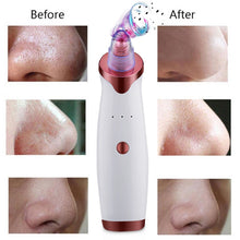 Load image into Gallery viewer, Electric Acne Remover Point Noir Blackhead Vacuum Extractor Tool - ROSAMISS STORE