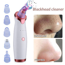 Load image into Gallery viewer, Electric Acne Remover Point Noir Blackhead Vacuum Extractor Tool - ROSAMISS STORE
